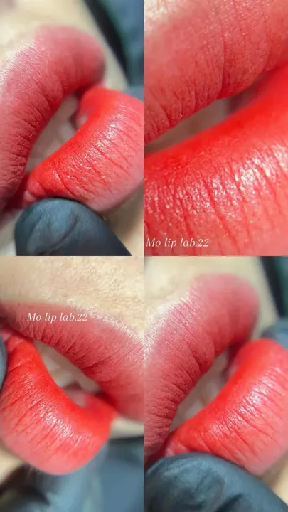 ภาพเปรียบเทียบฝังสีปาก ก่อนและหลัง