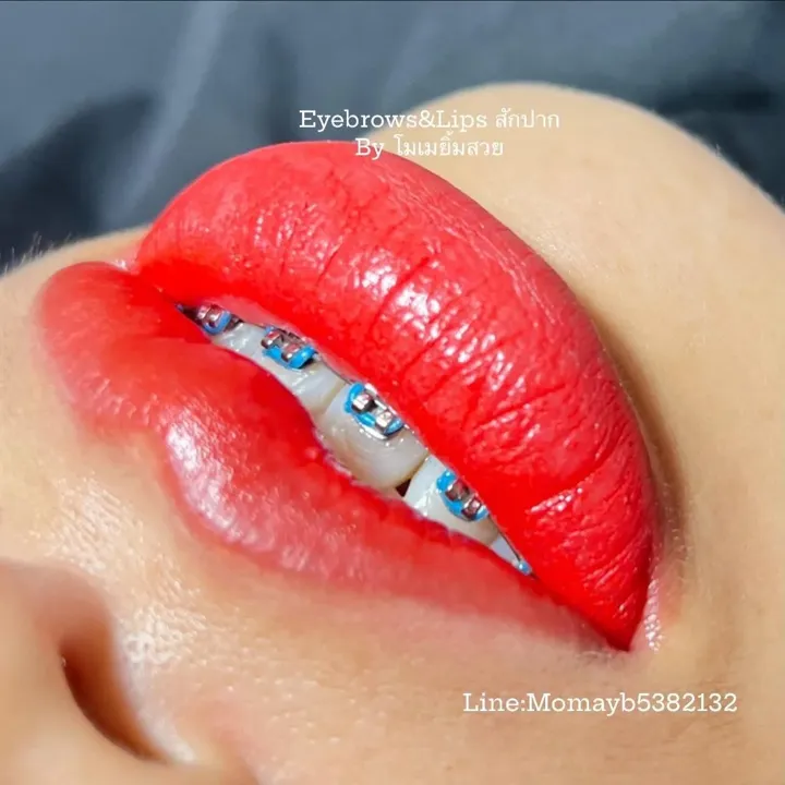 ผลงานฝังสีปาก Studio Momay