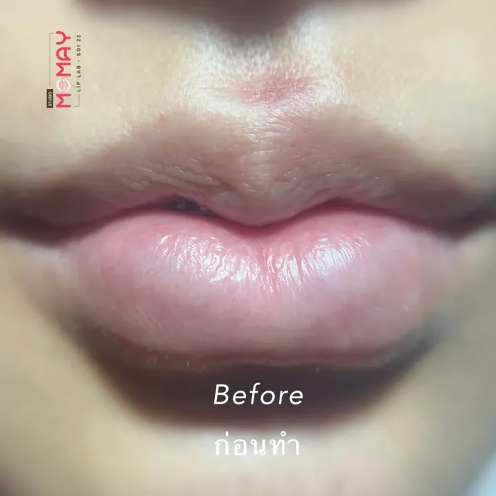 ริมฝีปากก่อนฝังสี